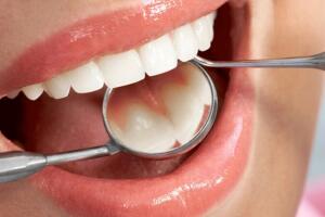 Dental hygiene prevention - Dentist Javea