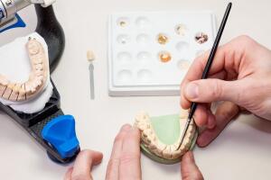 Dental laboratory, Denture Repair or Reline , Same Day
