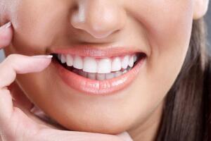 Smile aesthetics in Javea - Your dentist in Javea