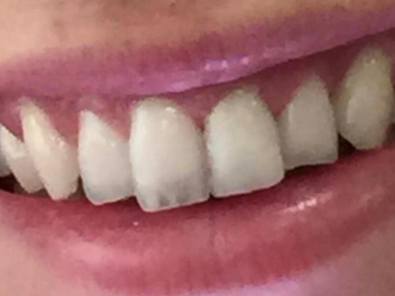 Before image