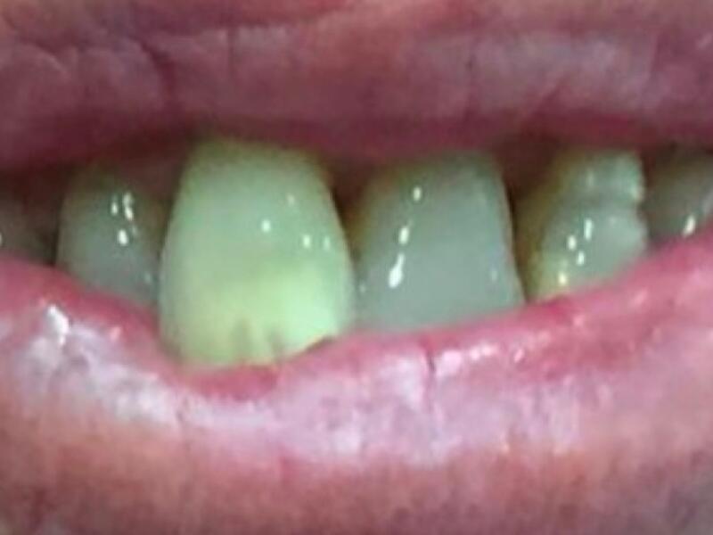 Before image