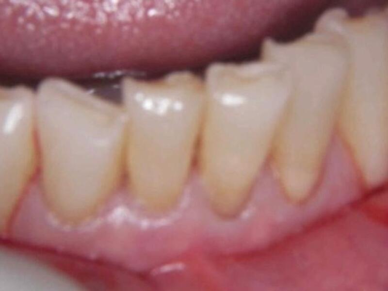 Before image