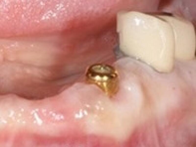 Before image