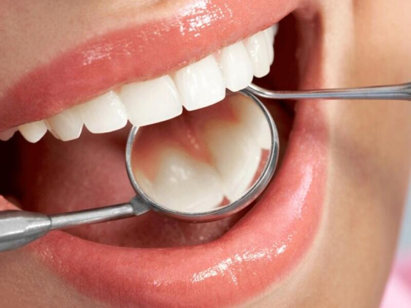 Dental hygiene prevention - Dentist Javea