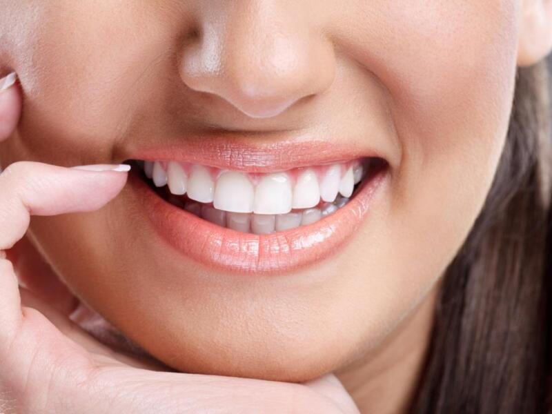 Smile aesthetics in Javea - Your dentist in Javea